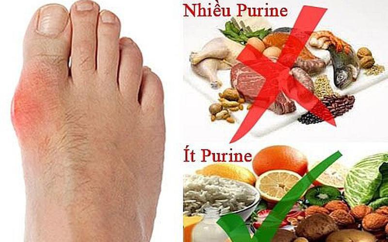 PURIN LÀ GÌ? NHỮNG LOẠI THỰC PHẨM GIÀU PURIN BỆNH NHÂN GOUT